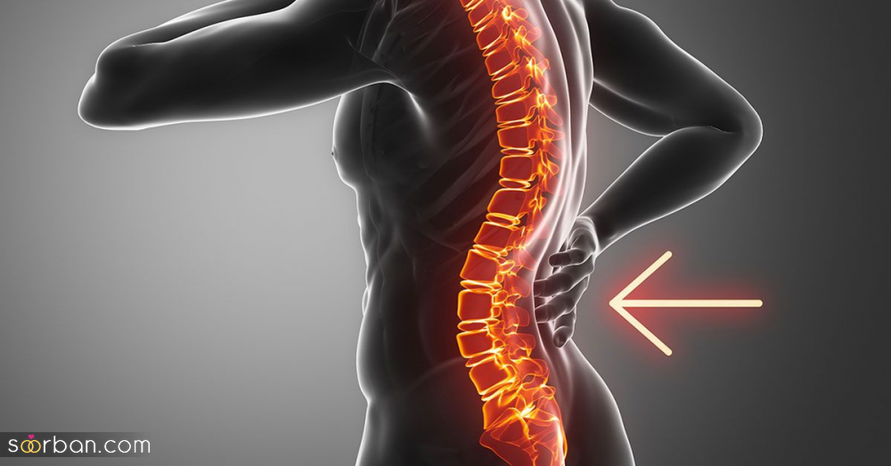 مهمترین ناهنجاری های ستون فقرات چیست؟ آشنایی با قوز پشت، گودی کمر و اسکولیوز