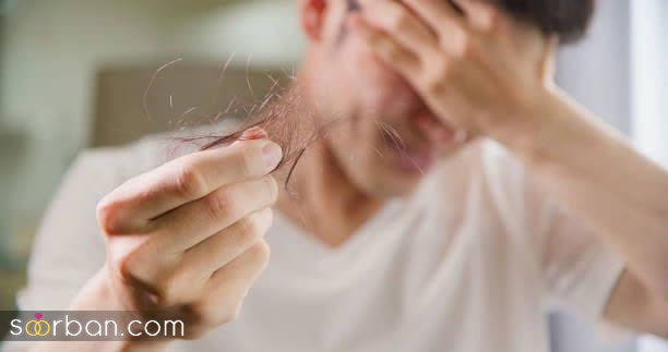 چرا موهامون میریزه ؟ + بررسی 9 علت شایع و مهم ریزش مو در زنان و مردان