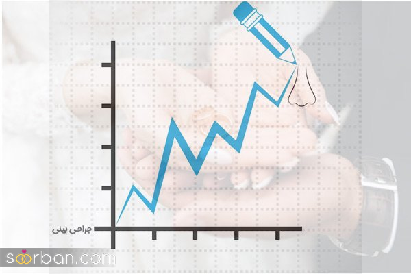 افزایش آمار عمل بینی بعد از ازدواج